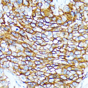 CD239/BCAM Rabbit Monoclonal Antibody - Image 2