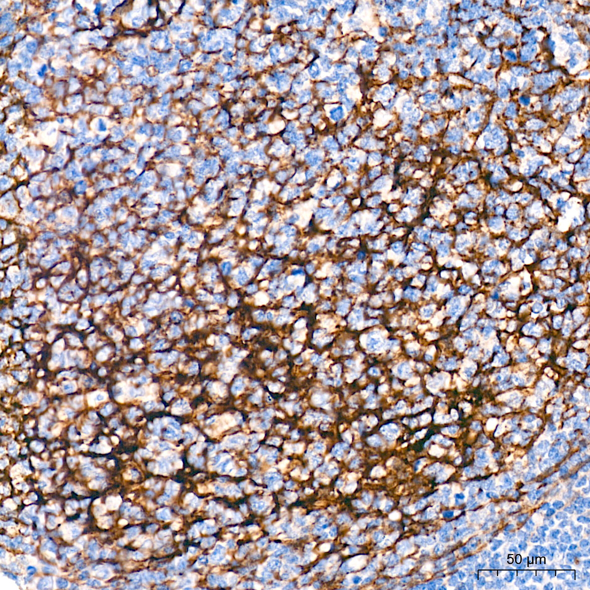 CD271 Rabbit Polyclonal Antibody