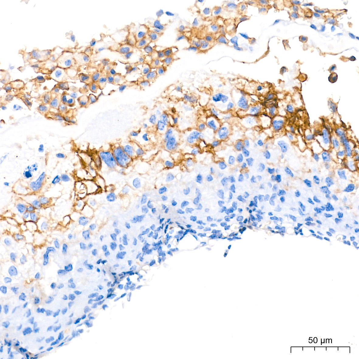 CD274 Rabbit Monoclonal Antibody - Image 3