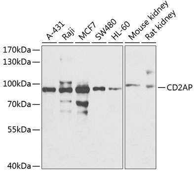 CD2AP Rabbit Polyclonal Antibody