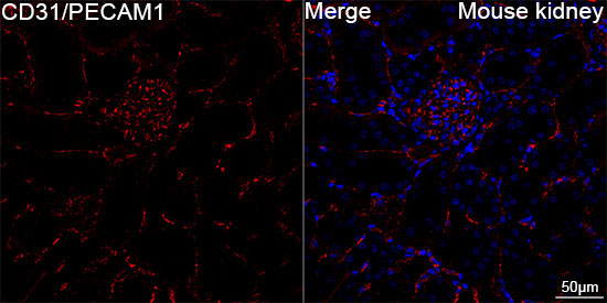 CD31/PECAM1 Rabbit Monoclonal Antibody - Image 3