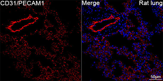 CD31/PECAM1 Rabbit Monoclonal Antibody - Image 5