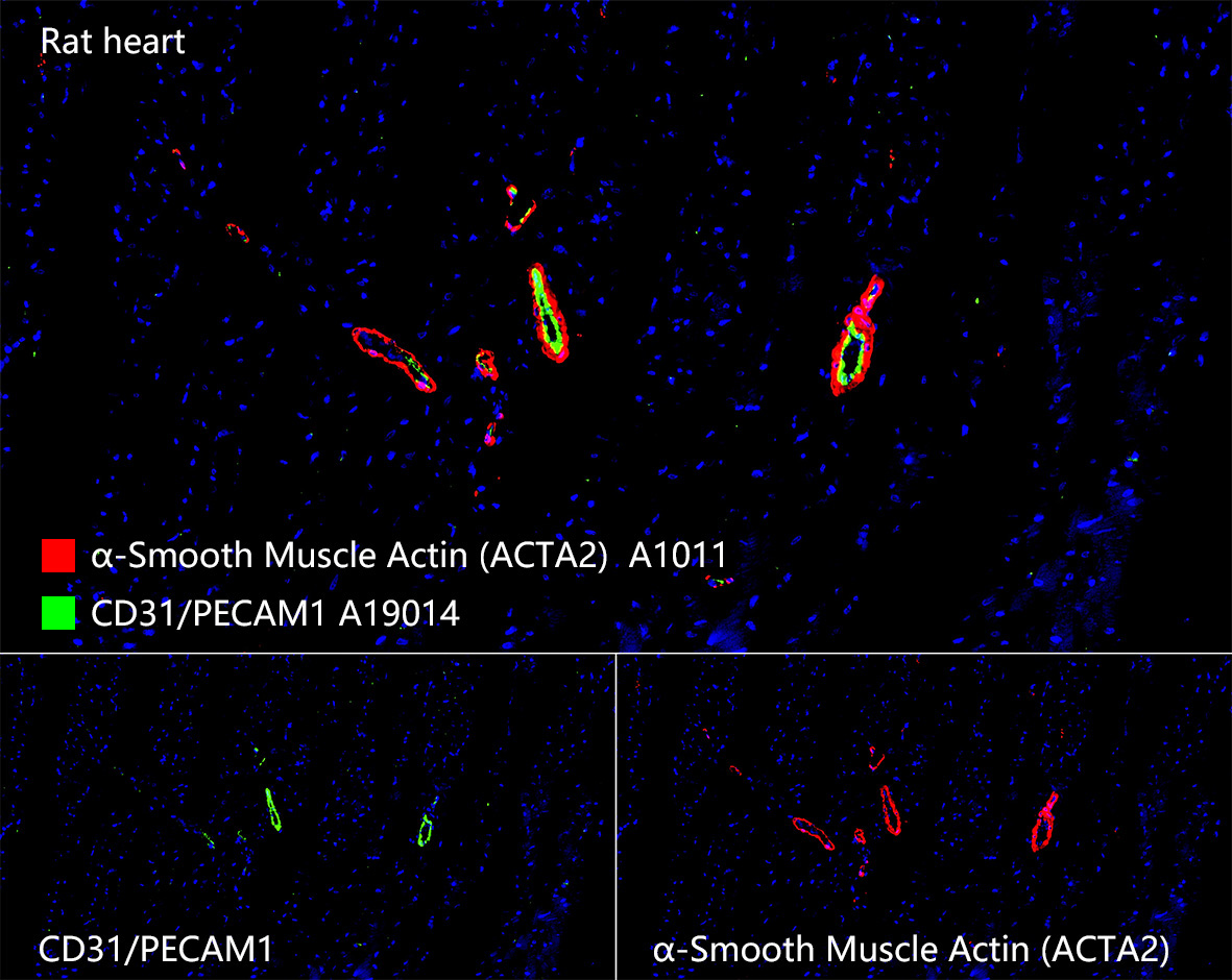 CD31/PECAM1 Rabbit Monoclonal Antibody - Image 8
