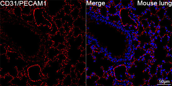 CD31/PECAM1 Rabbit Monoclonal Antibody - Image 11
