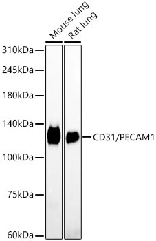 CD31/PECAM1 Rabbit Monoclonal Antibody - Image 12