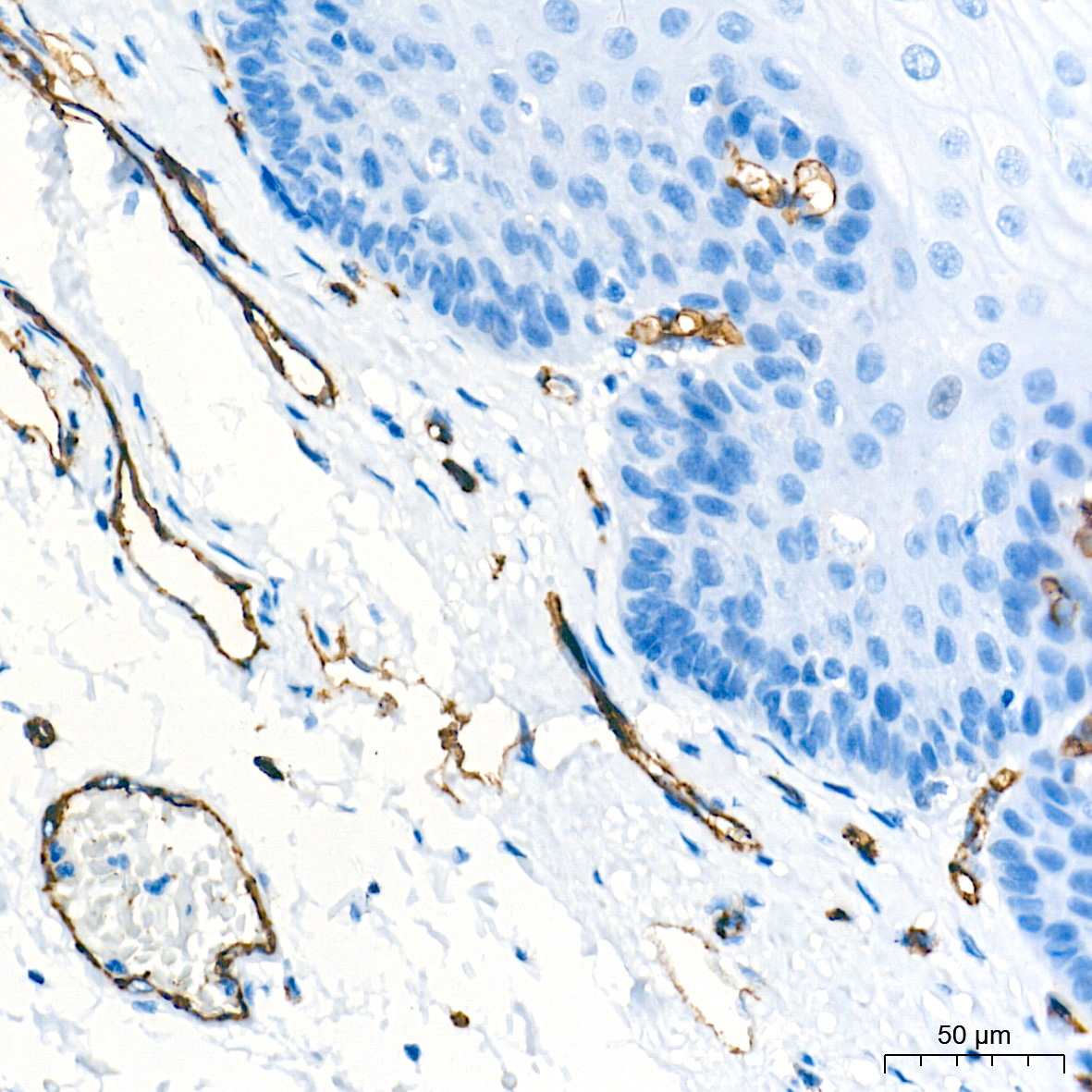 CD31/PECAM1 Rabbit Monoclonal Antibody - Image 13