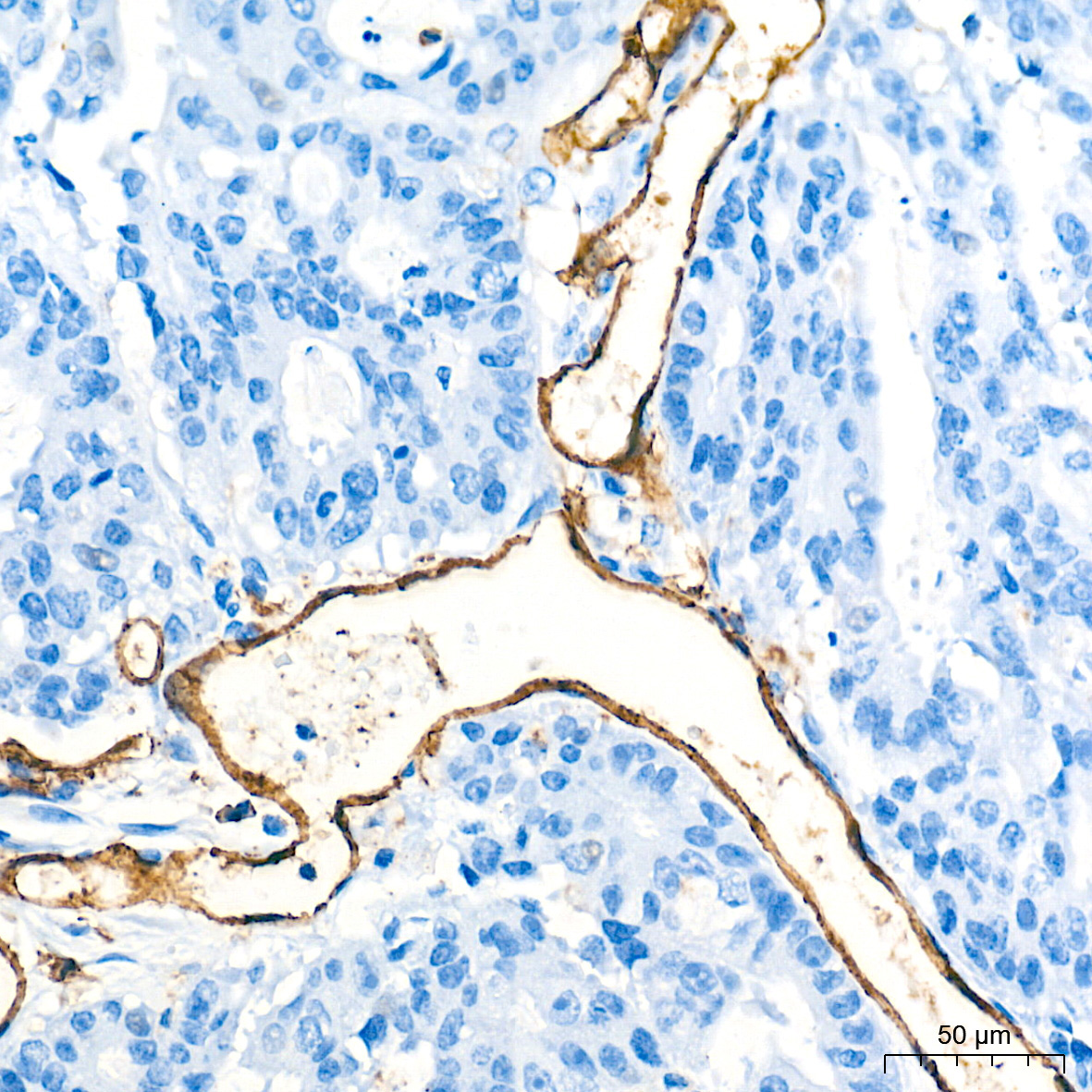 CD31/PECAM1 Rabbit Monoclonal Antibody - Image 14
