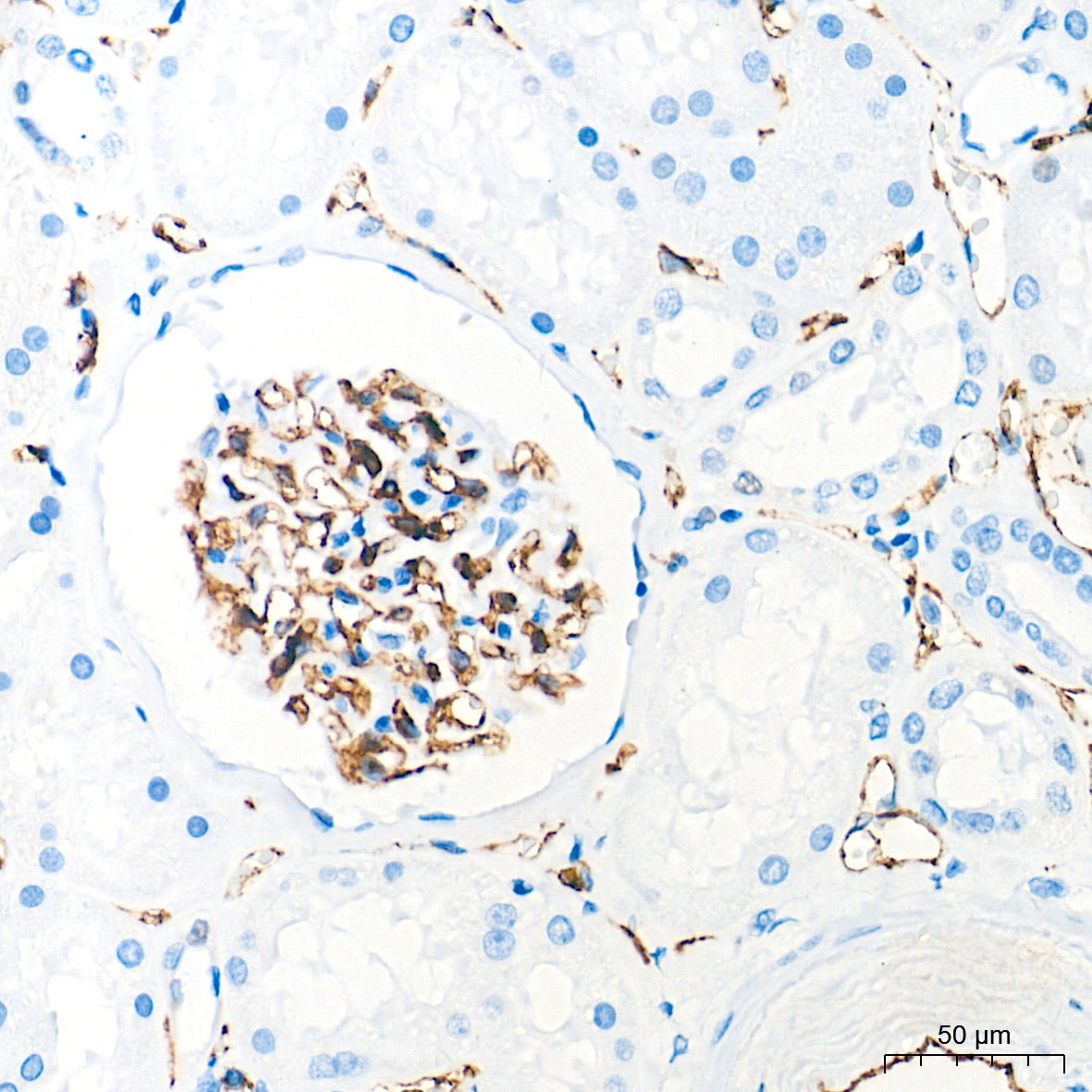 CD31/PECAM1 Rabbit Monoclonal Antibody - Image 15