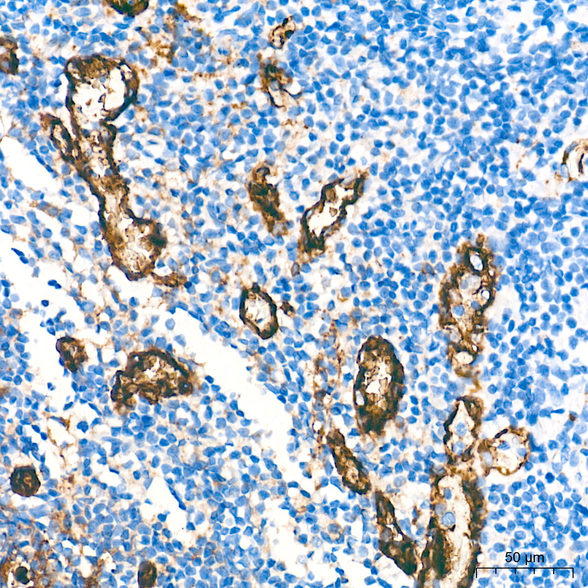 CD31/PECAM1 Rabbit Monoclonal Antibody - Image 16