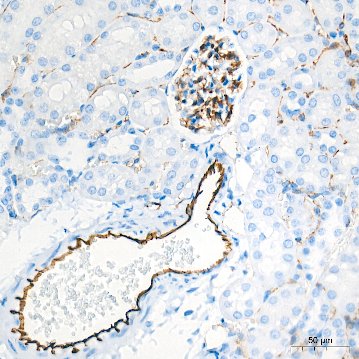 CD31/PECAM1 Rabbit Monoclonal Antibody - Image 17