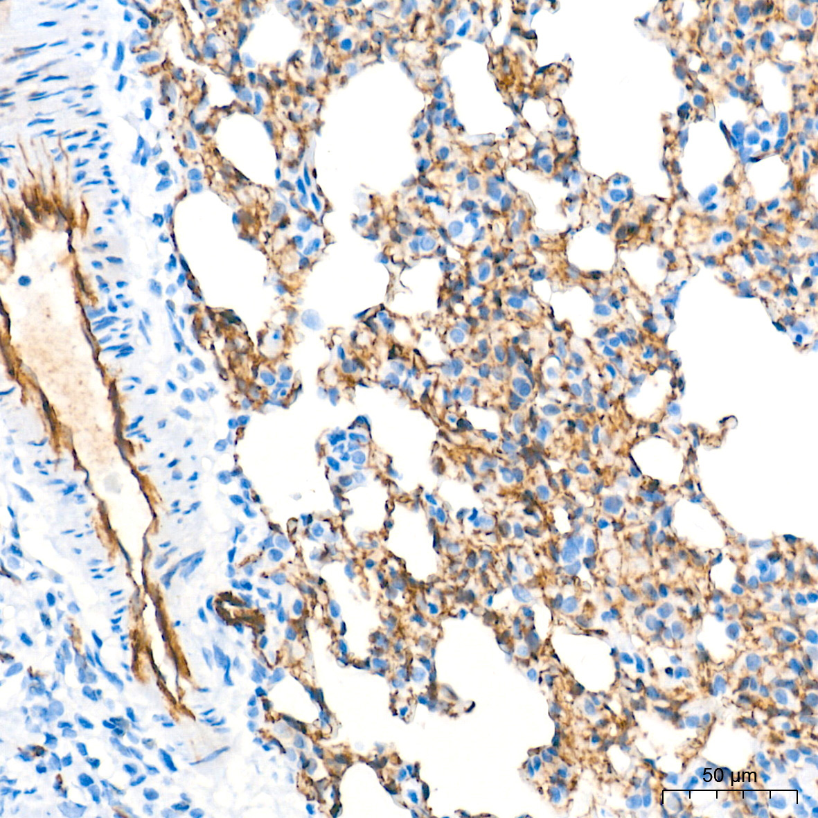 CD31/PECAM1 Rabbit Monoclonal Antibody - Image 18