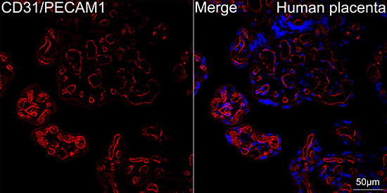 CD31/PECAM1 Rabbit Monoclonal Antibody - Image 19