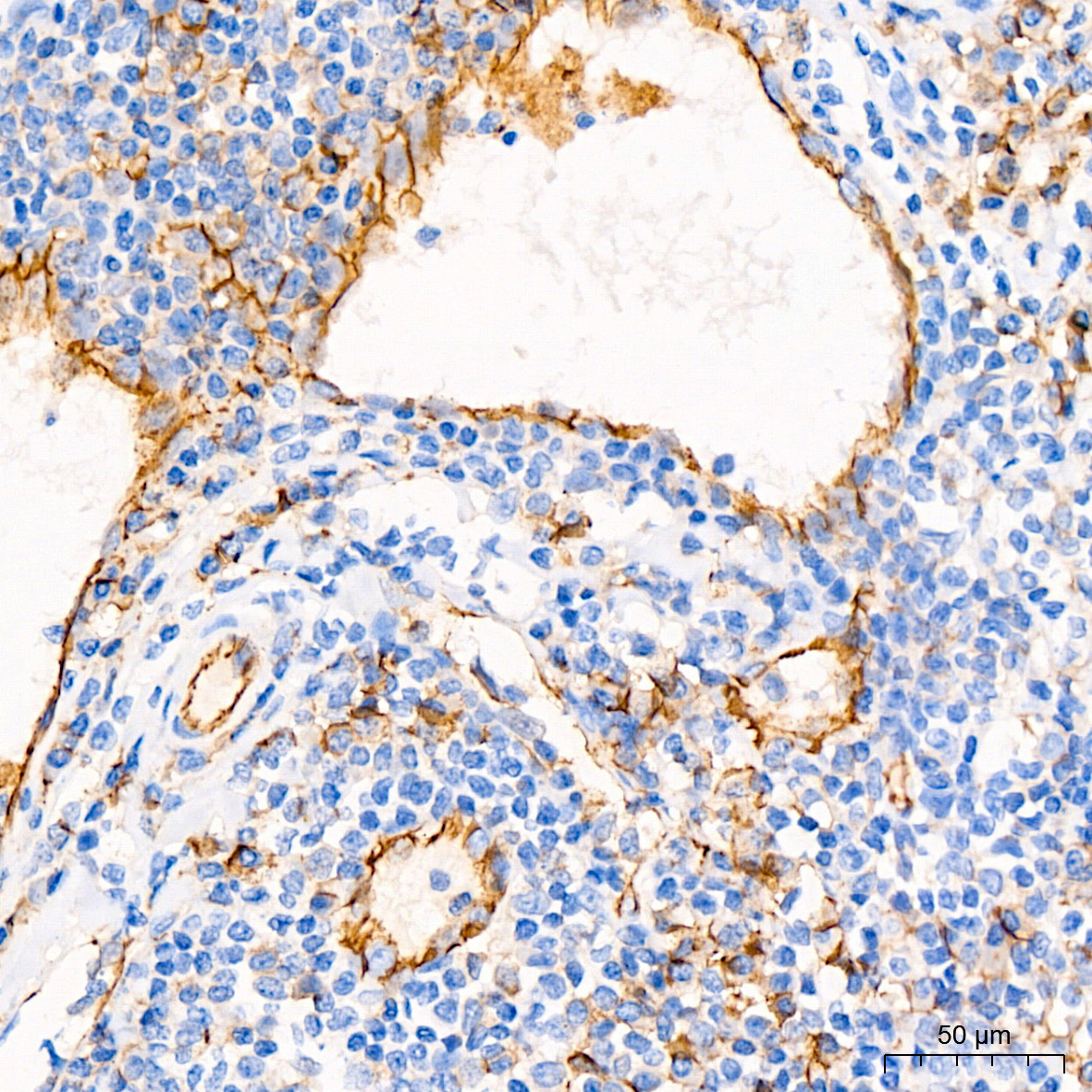 CD31/PECAM1 Rabbit Monoclonal Antibody - Image 3