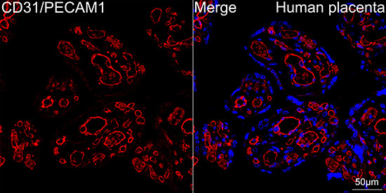 CD31/PECAM1 Rabbit Monoclonal Antibody - Image 2