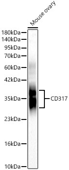 CD317 Rabbit Polyclonal Antibody