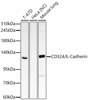 CD324/E-Cadherin Rabbit Polyclonal Antibody