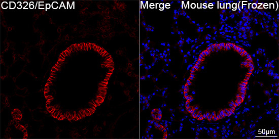 CD326/EpCAM Rabbit Monoclonal Antibody - Image 4