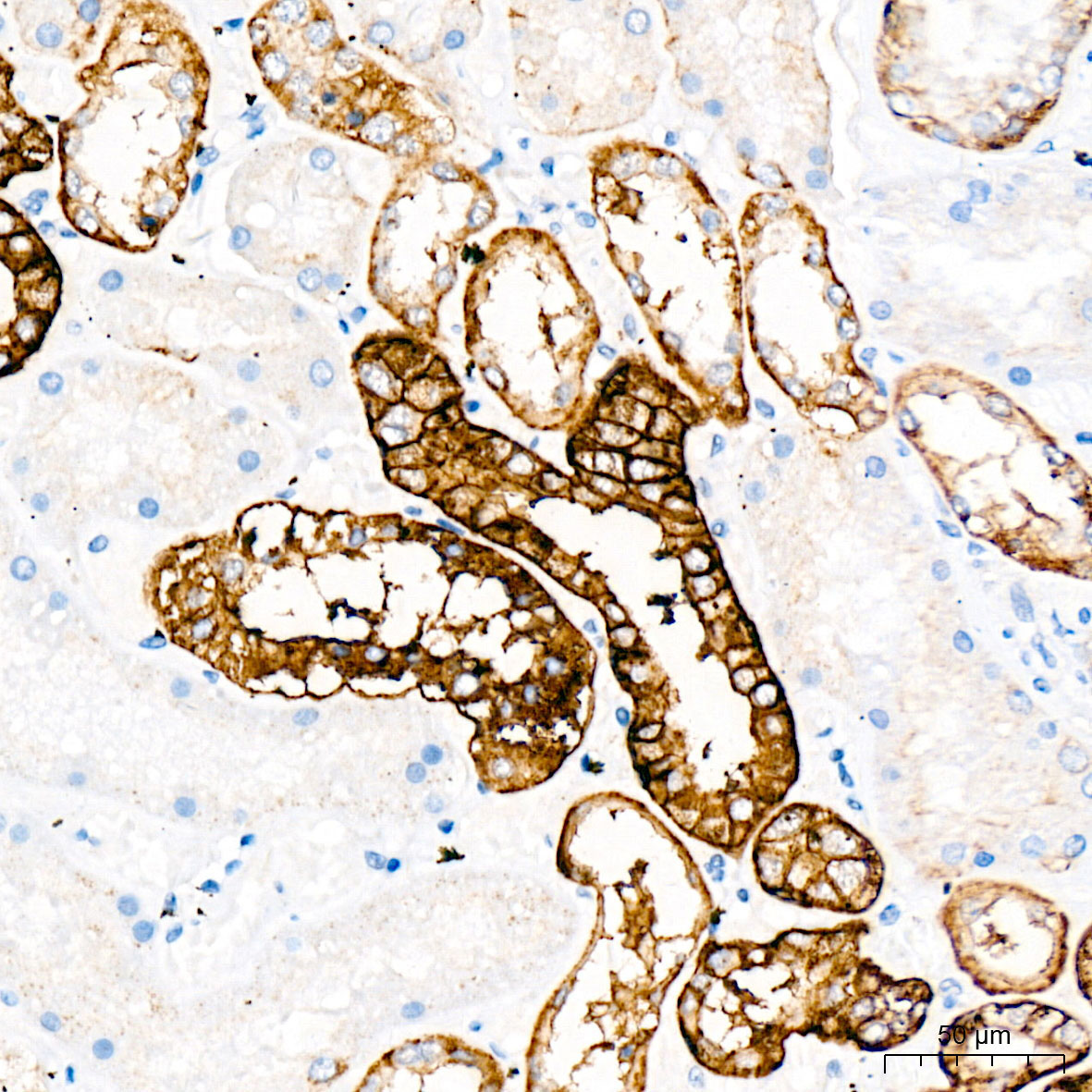 CD326/EpCAM Rabbit Monoclonal Antibody - Image 6