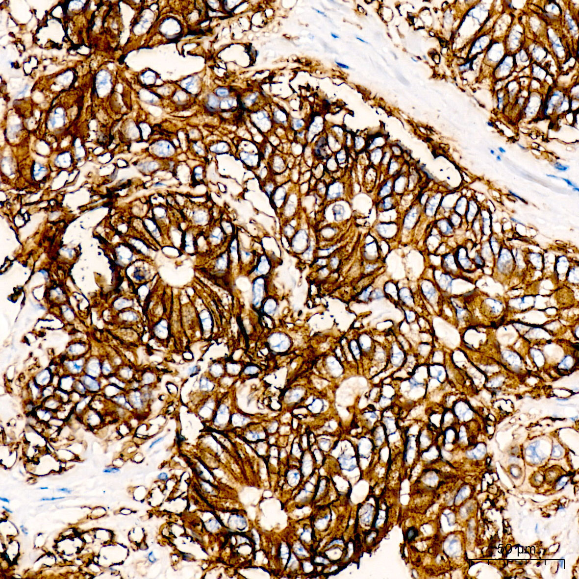 CD326/EpCAM Rabbit Monoclonal Antibody - Image 7