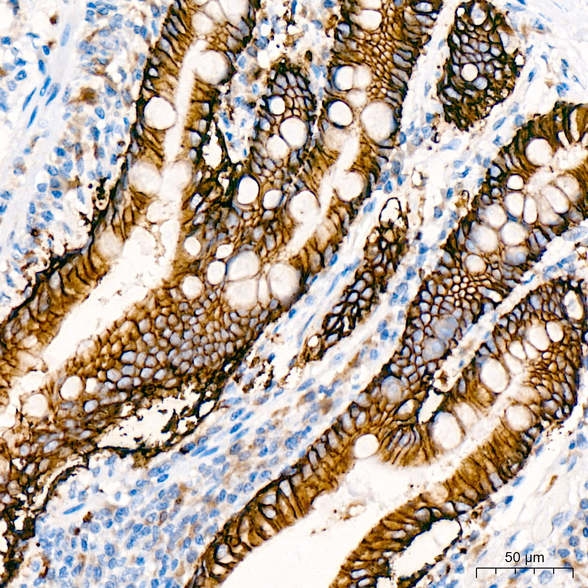 CD326/EpCAM Rabbit Monoclonal Antibody - Image 8