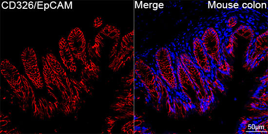 CD326/EpCAM Rabbit Monoclonal Antibody - Image 10