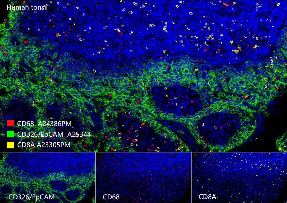 CD326/EpCAM Rabbit Monoclonal Antibody - Image 12