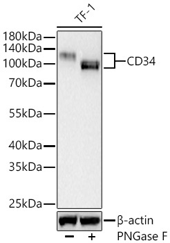 CD34 Rabbit Monoclonal Antibody