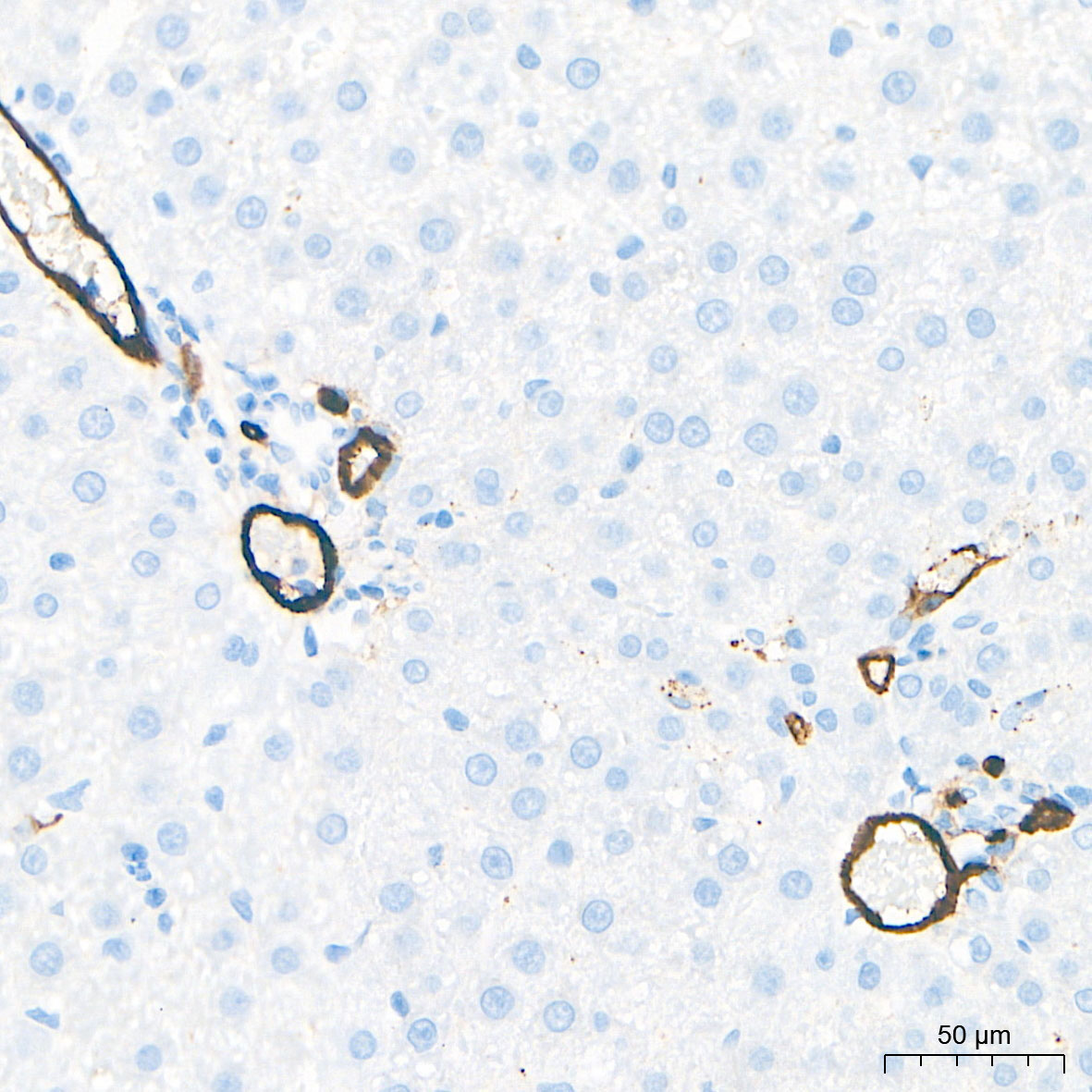 CD34 Rabbit Monoclonal Antibody - Image 2