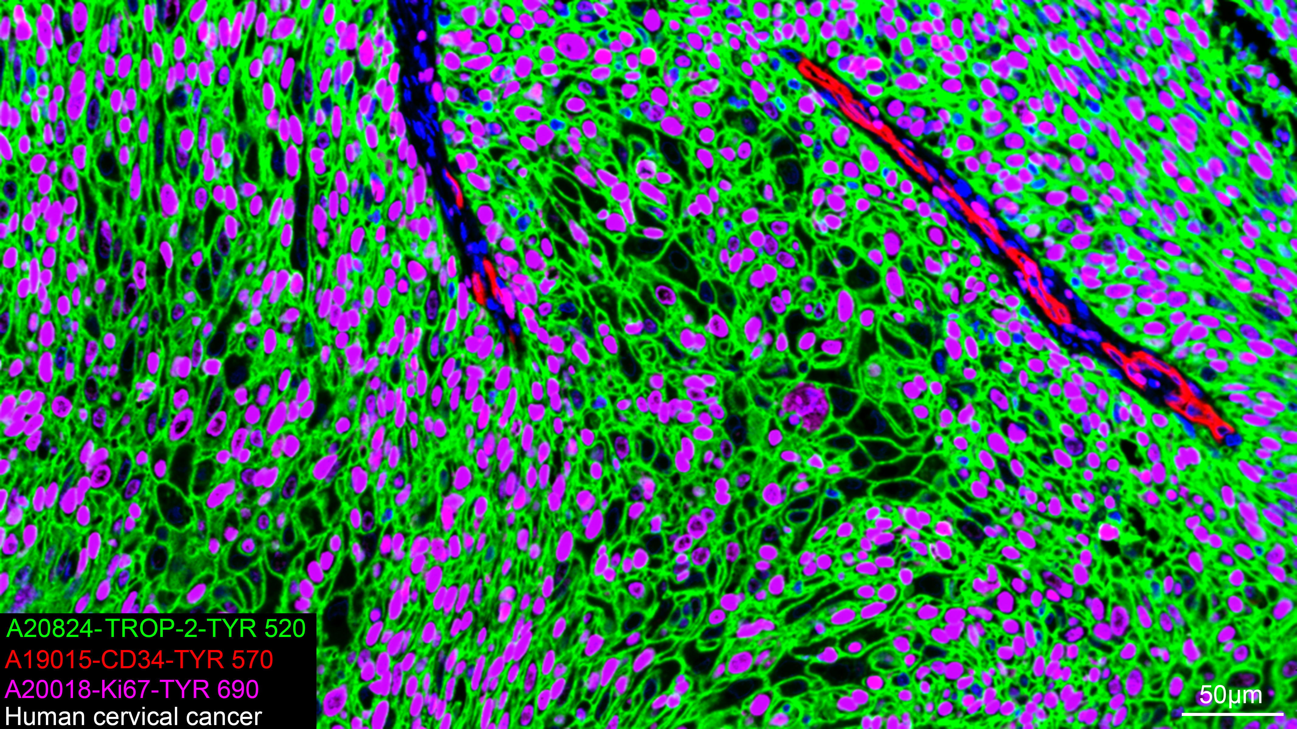 CD34 Rabbit Monoclonal Antibody - Image 3