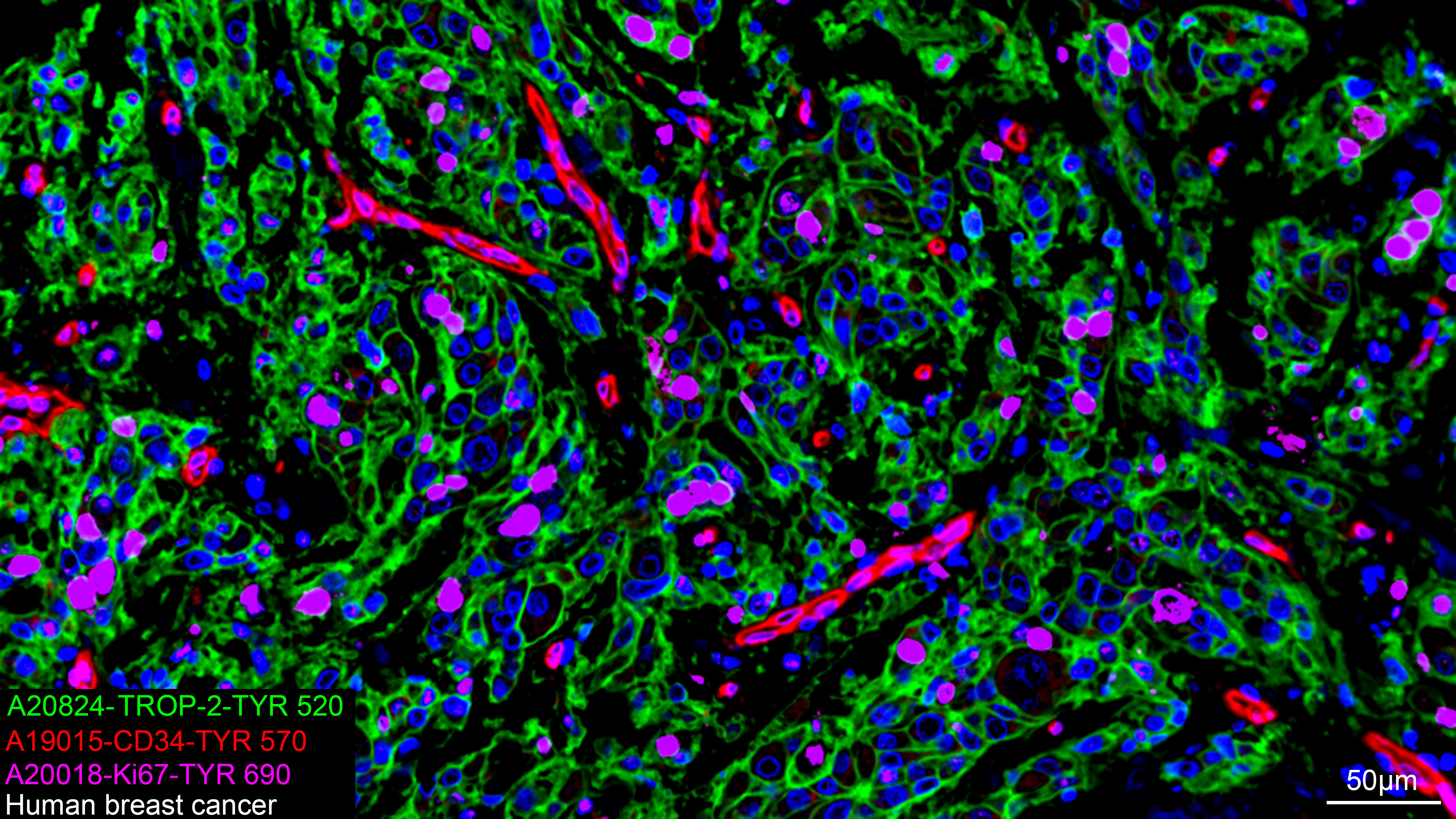 CD34 Rabbit Monoclonal Antibody - Image 4