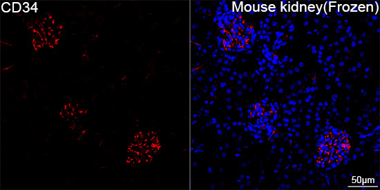 CD34 Rabbit Monoclonal Antibody - Image 5
