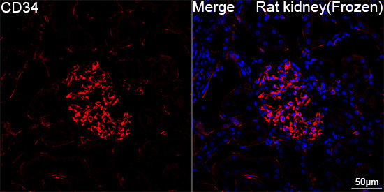 CD34 Rabbit Monoclonal Antibody - Image 6