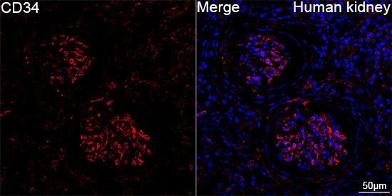 CD34 Rabbit Monoclonal Antibody - Image 7