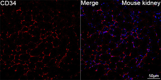 CD34 Rabbit Monoclonal Antibody - Image 8