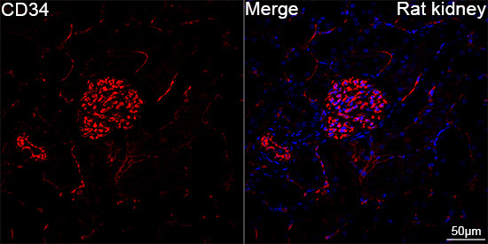 CD34 Rabbit Monoclonal Antibody - Image 9
