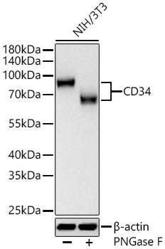 CD34 Rabbit Monoclonal Antibody - Image 10