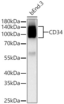 CD34 Rabbit Monoclonal Antibody - Image 11