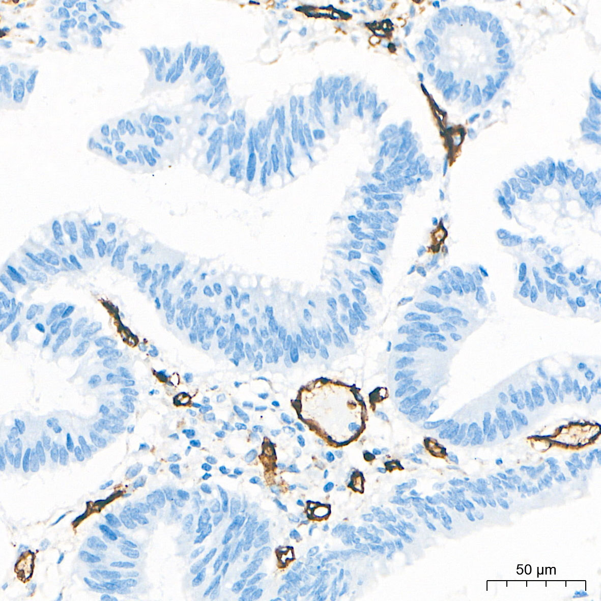 CD34 Rabbit Monoclonal Antibody - Image 12