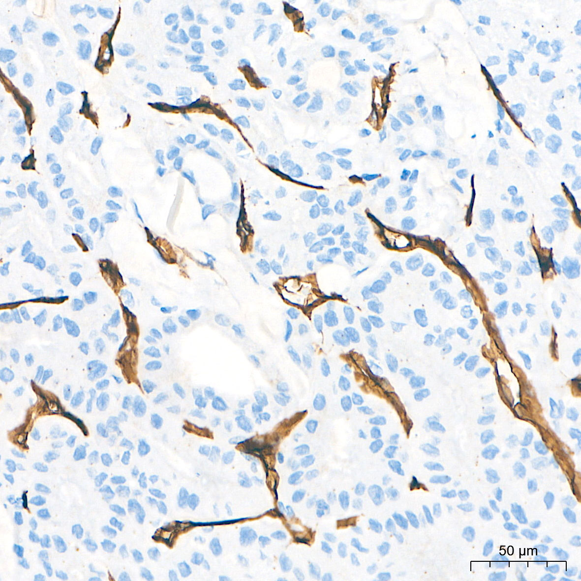 CD34 Rabbit Monoclonal Antibody - Image 13