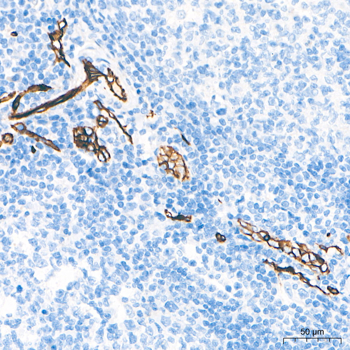 CD34 Rabbit Monoclonal Antibody - Image 14