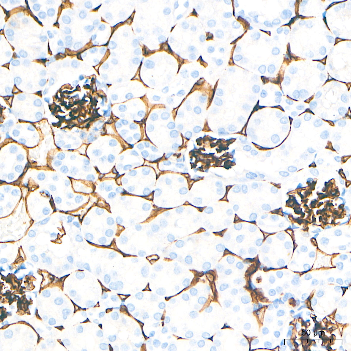 CD34 Rabbit Monoclonal Antibody - Image 15