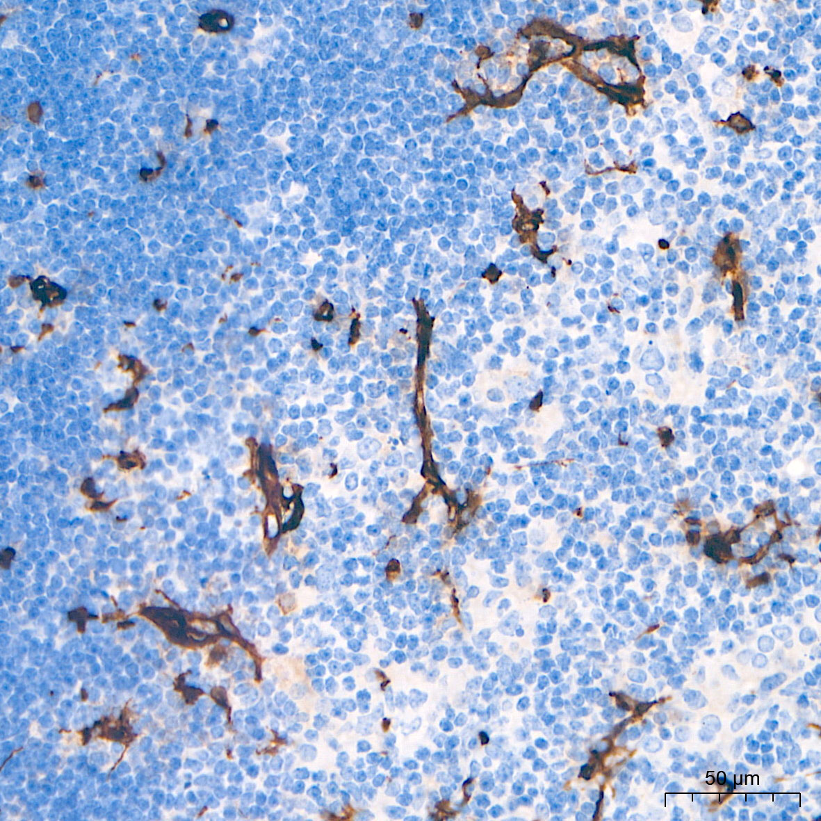 CD34 Rabbit Monoclonal Antibody - Image 16