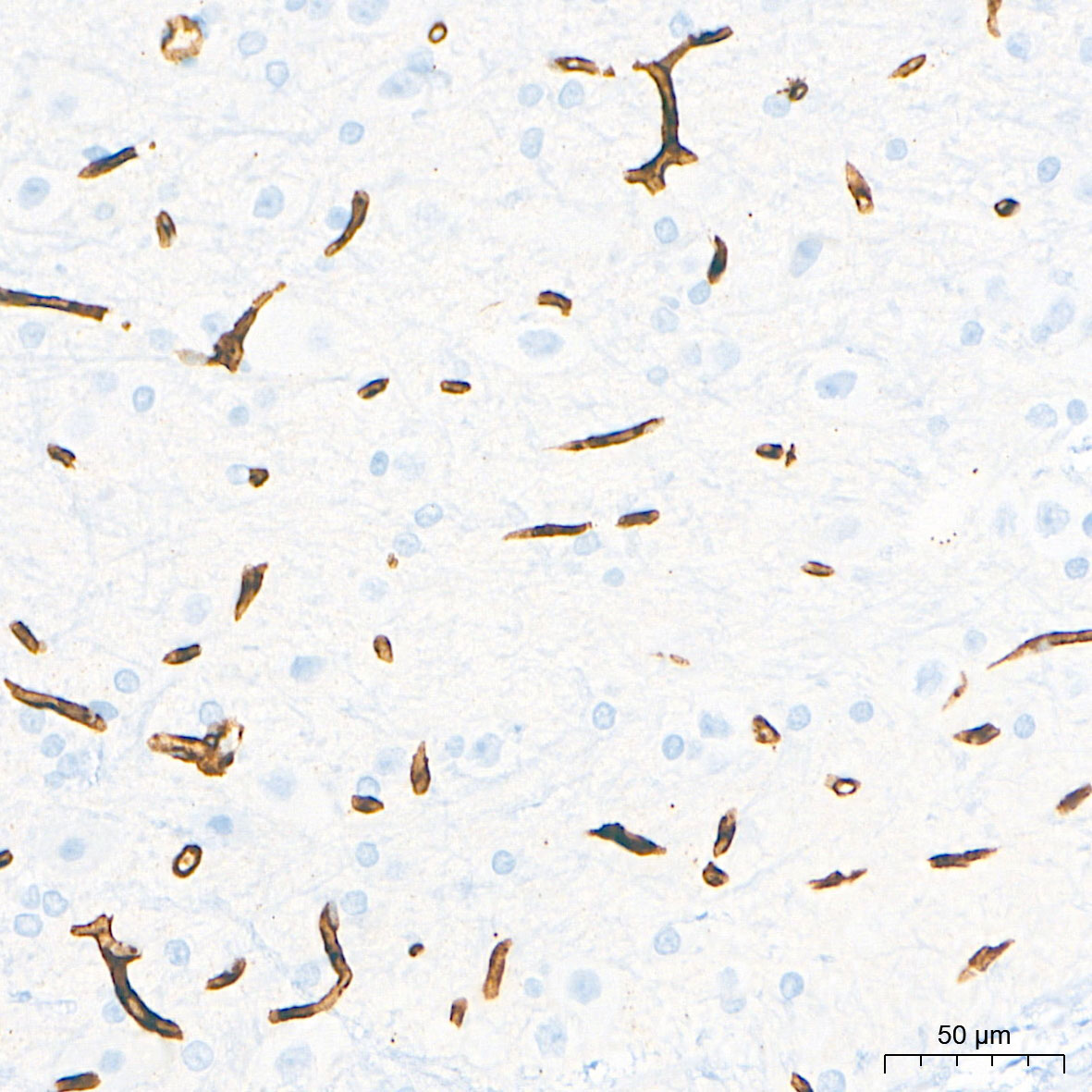 CD34 Rabbit Monoclonal Antibody - Image 17