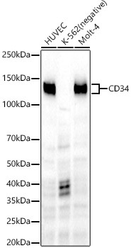 CD34 Rabbit Monoclonal Antibody