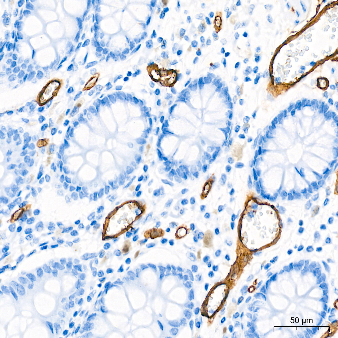 CD34 Rabbit Monoclonal Antibody - Image 2