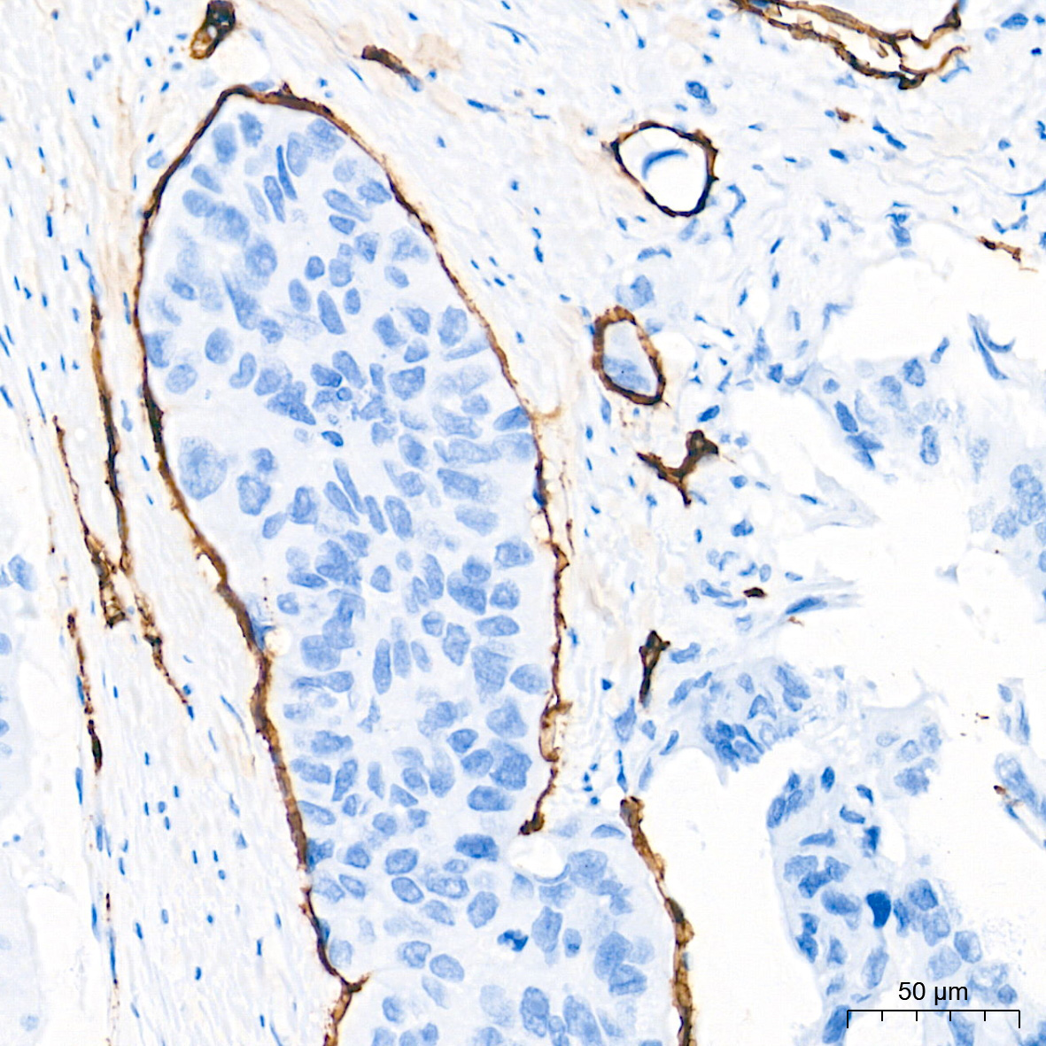 CD34 Rabbit Monoclonal Antibody - Image 3
