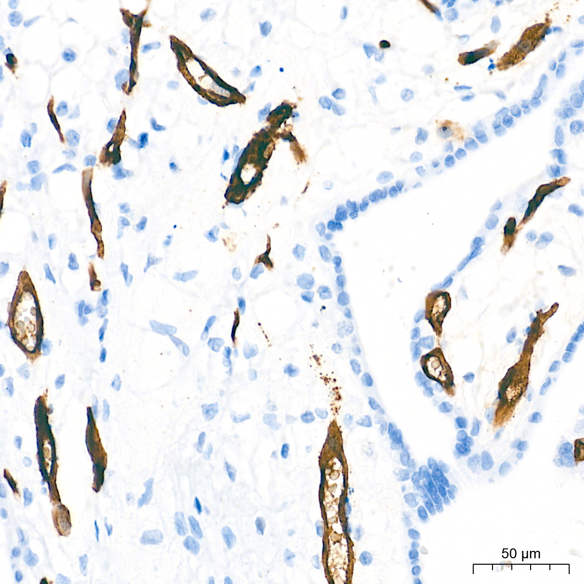 CD34 Rabbit Monoclonal Antibody - Image 4