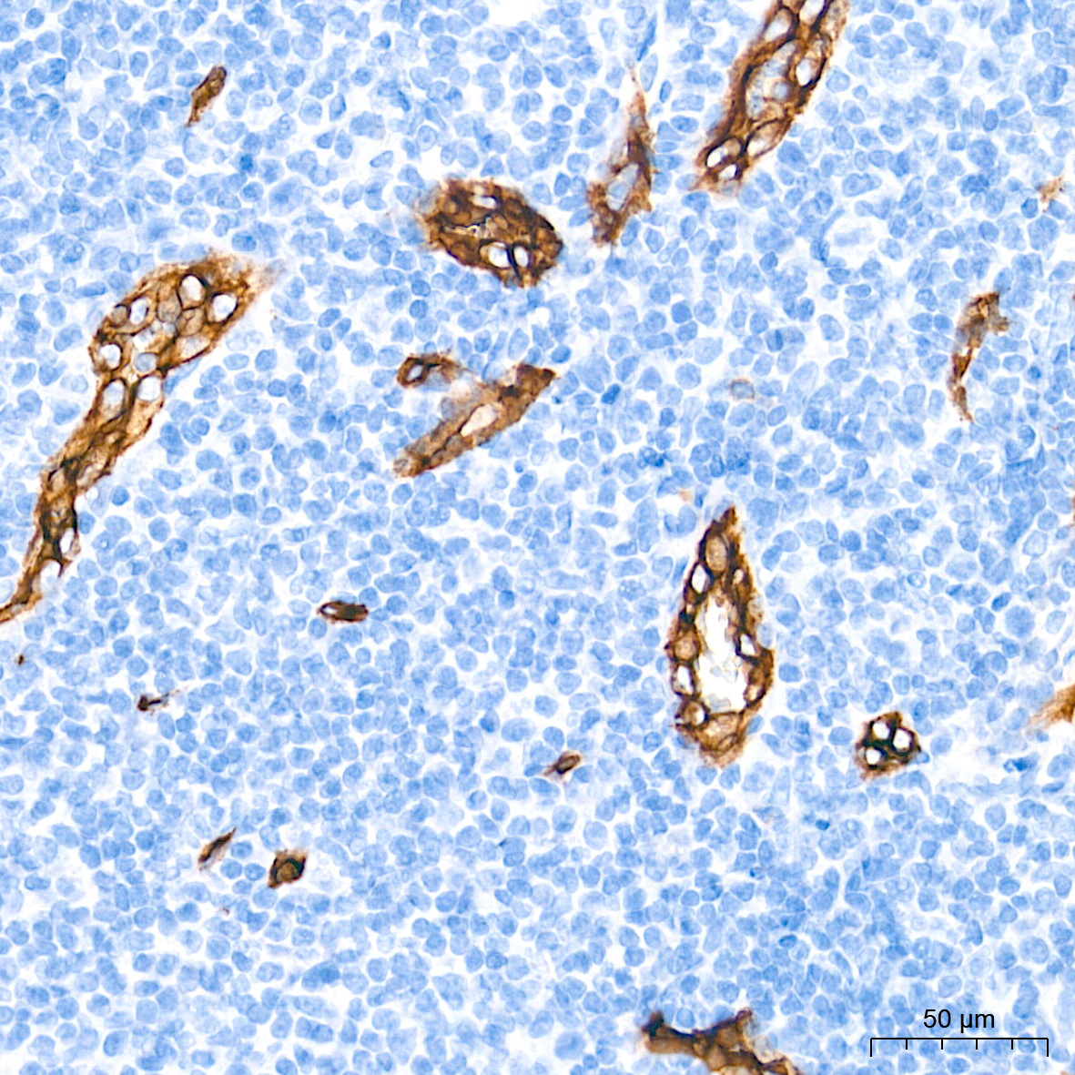 CD34 Rabbit Monoclonal Antibody - Image 5