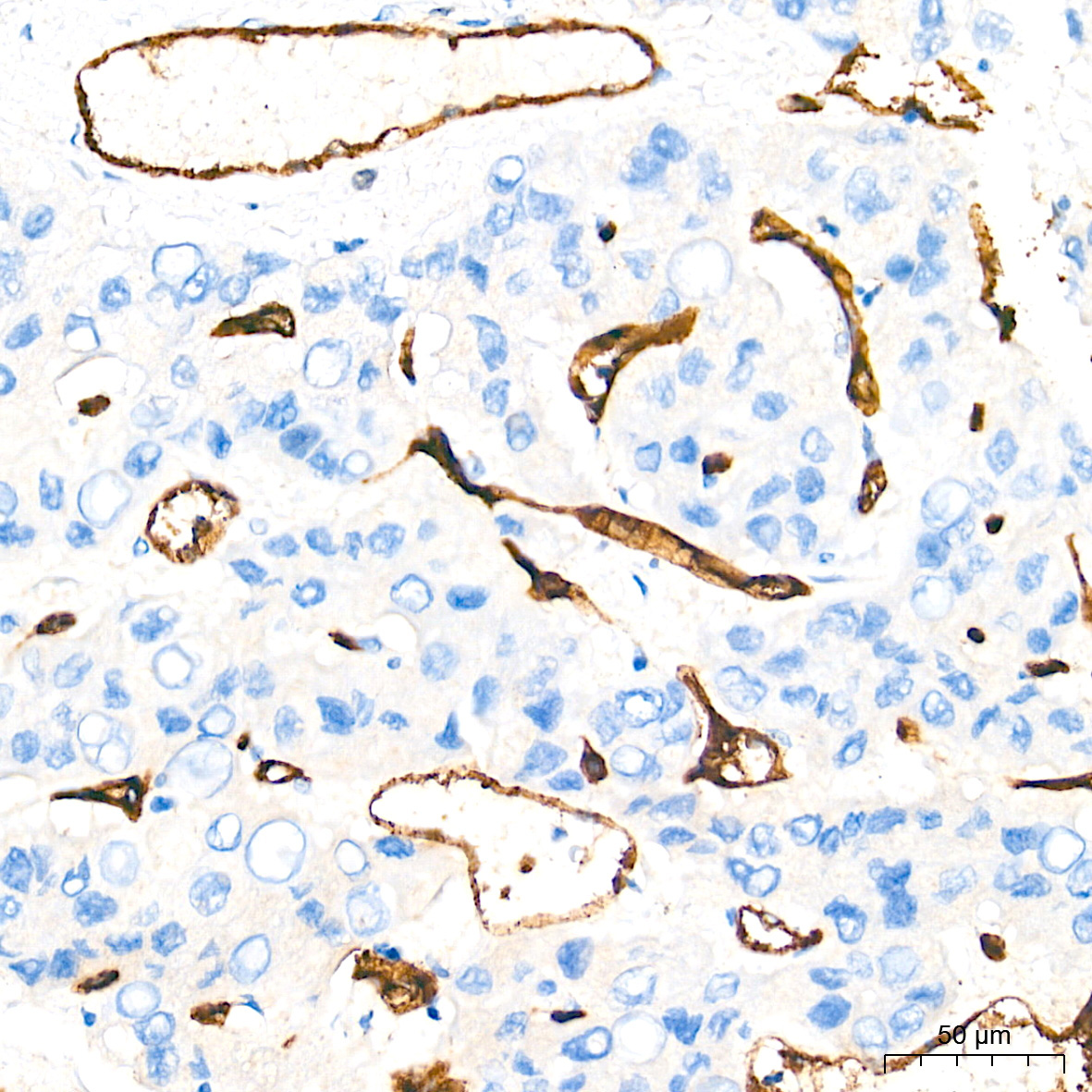 CD34 Rabbit Monoclonal Antibody - Image 6