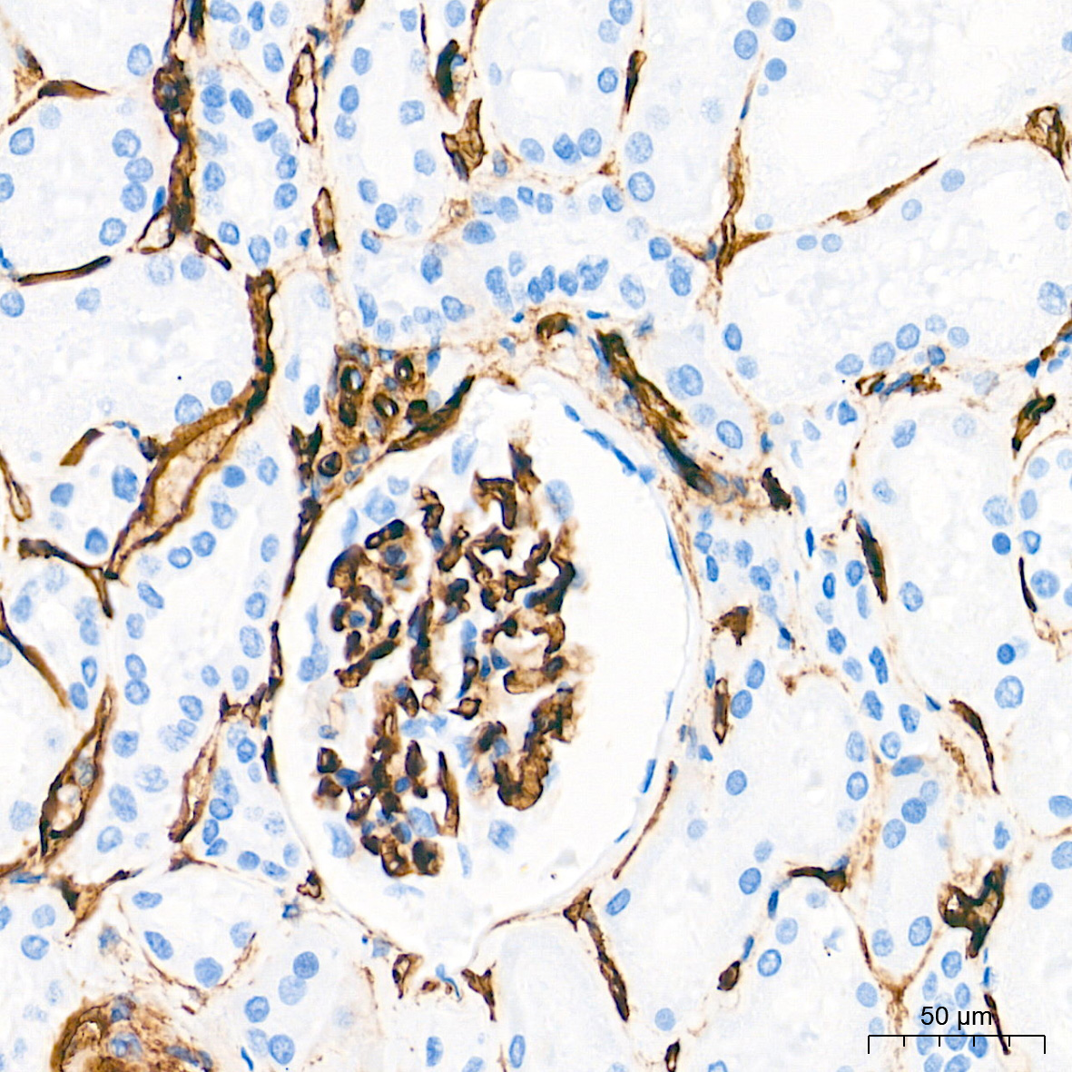 CD34 Rabbit Monoclonal Antibody - Image 7